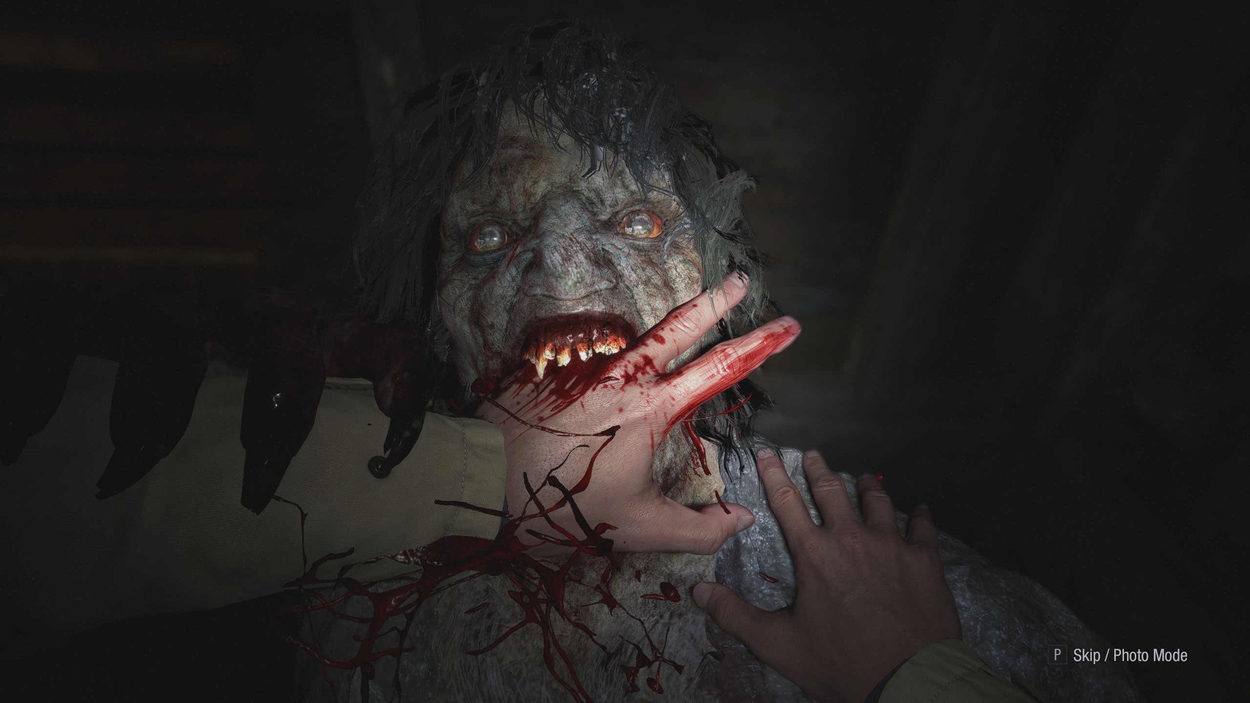 Egy likán zombi leharapja Ethan ujjait